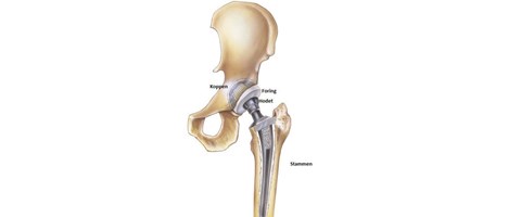 illustrasjon som viser hoftens oppbygging. 